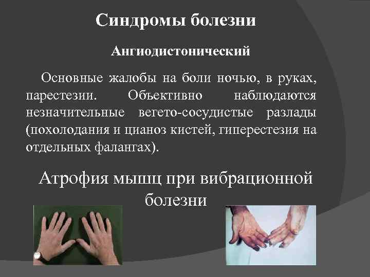 Парестезия как лечить