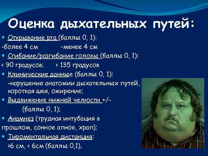 Оценка дыхательных путей: Открывание рта (баллы 0, 1): -более 4 см -менее 4 см
