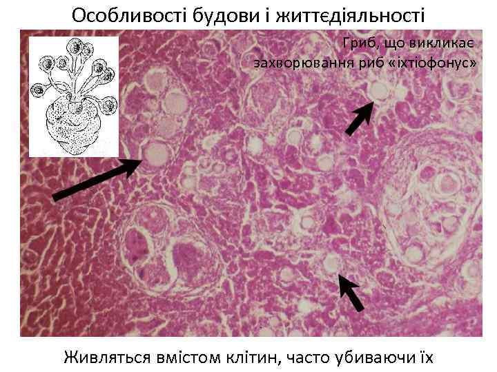 Особливості будови і життєдіяльності Гриб, що викликає захворювання риб «іхтіофонус» Живляться вмістом клітин, часто