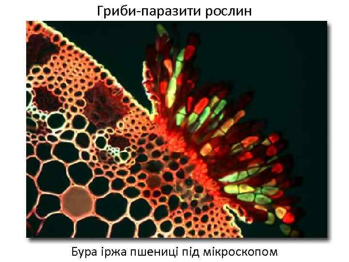 Гриби-паразити рослин Бура іржа пшениці під мікроскопом 