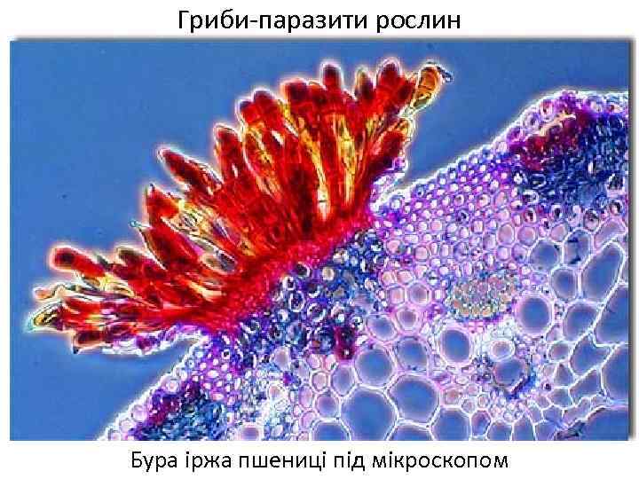 Гриби-паразити рослин Бура іржа пшениці під мікроскопом 