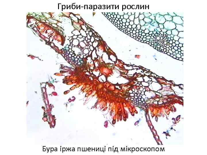 Гриби-паразити рослин Бура іржа пшениці під мікроскопом 