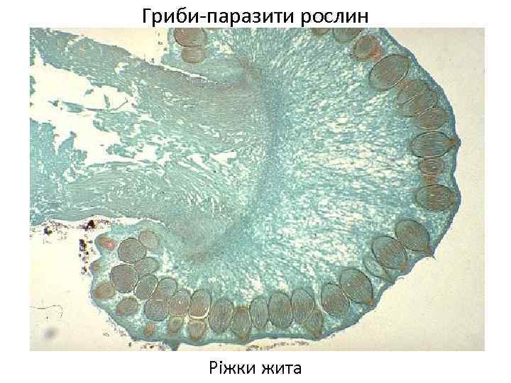 Гриби-паразити рослин Ріжки жита 