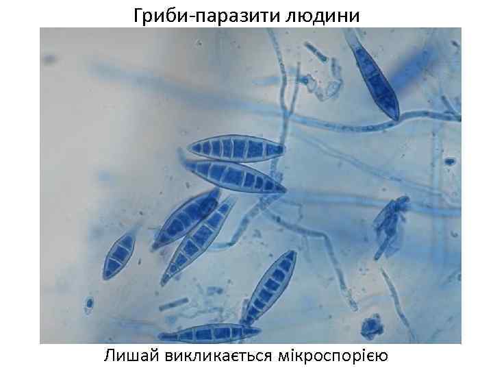 Гриби-паразити людини Лишай викликається мікроспорією 