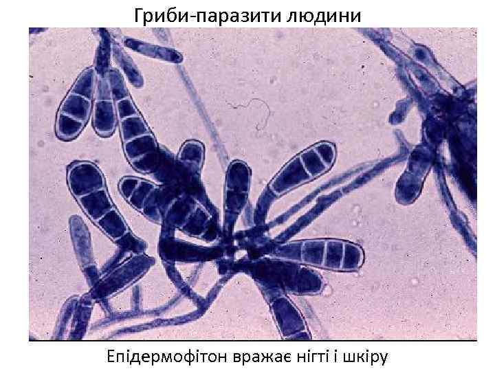 Гриби-паразити людини Епідермофітон вражає нігті і шкіру 