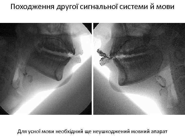 Походження другої сигнальної системи й мови Для усної мови необхідний ще неушкоджений мовний апарат