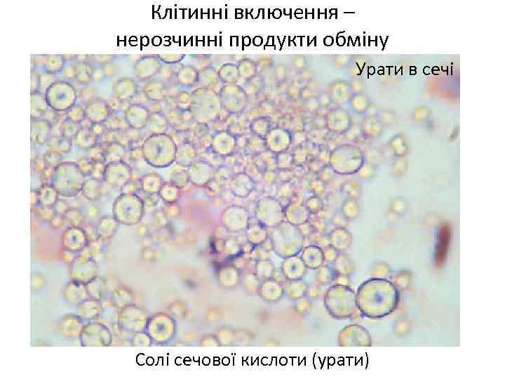 Клітинні включення – нерозчинні продукти обміну Урати в сечі Солі сечової кислоти (урати) 