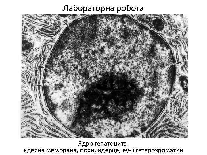 Извлечение соматического ядра клетки. Ядрышко Электронограмма. Ядро клетки микрофотография. Электронограмма ядра клетки. Микрофотография митохондрии клетки.