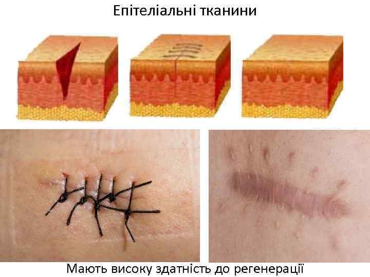 Епітеліальні тканини Мають високу здатність до регенерації 