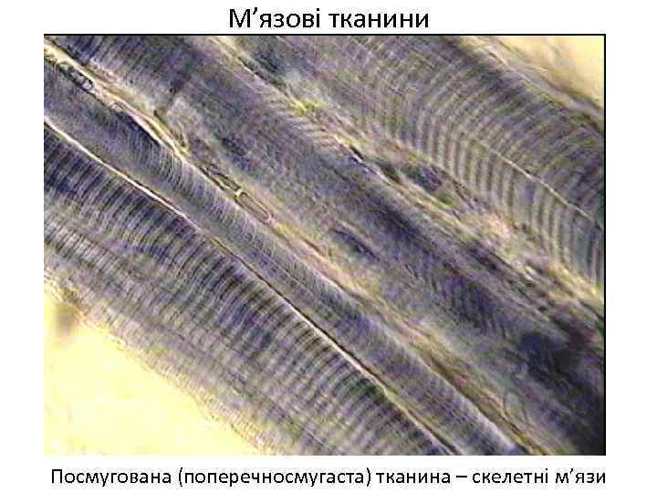 М’язові тканини Посмугована (поперечносмугаста) тканина – скелетні м’язи 