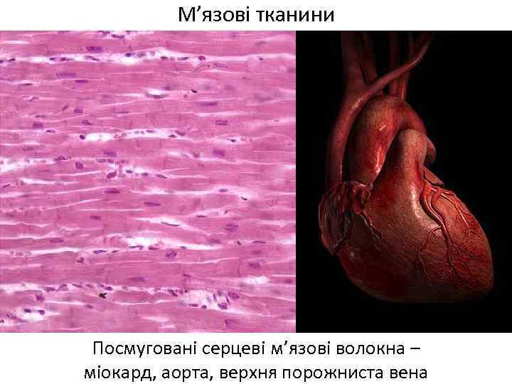 М’язові тканини Посмуговані серцеві м’язові волокна – міокард, аорта, верхня порожниста вена 