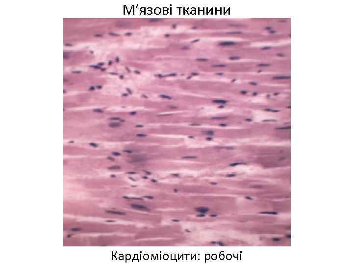 М’язові тканини Кардіоміоцити: робочі 