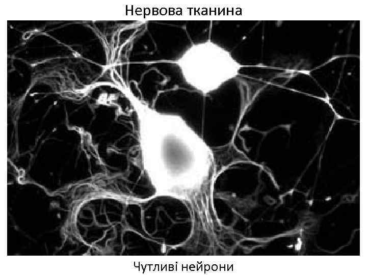 Нервова тканина Чутливі нейрони 