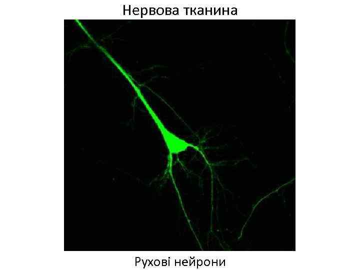 Нервова тканина Рухові нейрони 