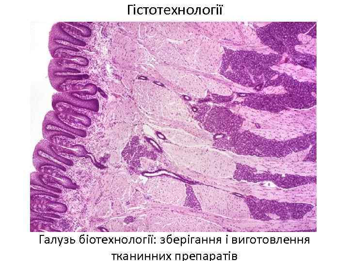 Гістотехнології Галузь біотехнології: зберігання і виготовлення тканинних препаратів 