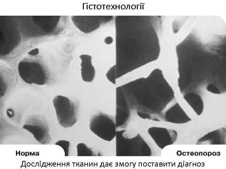 Гістотехнології Дослідження тканин дає змогу поставити діагноз 