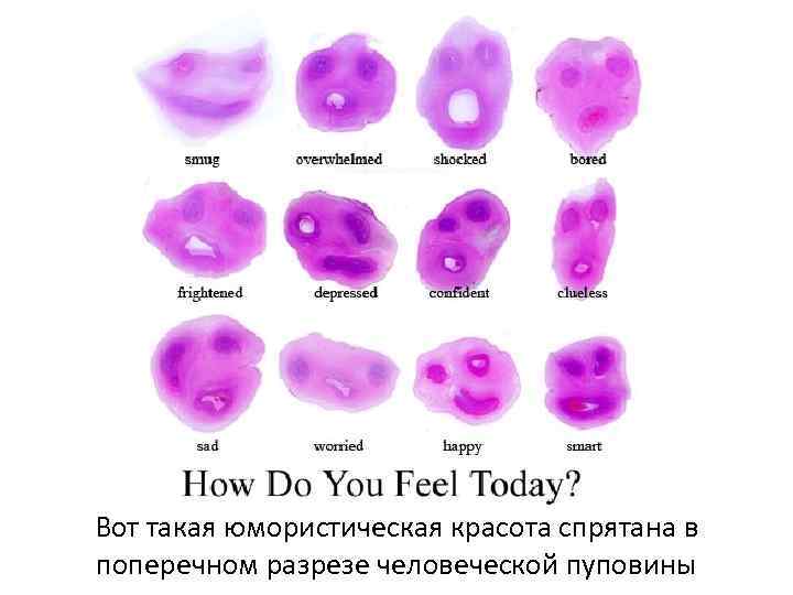 Гістотехнології Вот такая юмористическая красота спрятана в поперечном разрезе человеческой пуповины 