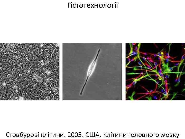Гістотехнології Стовбурові клітини. 2005. США. Клітини головного мозку 