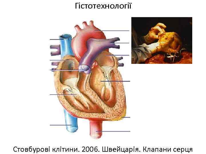 Гістотехнології Стовбурові клітини. 2006. Швейцарія. Клапани серця 