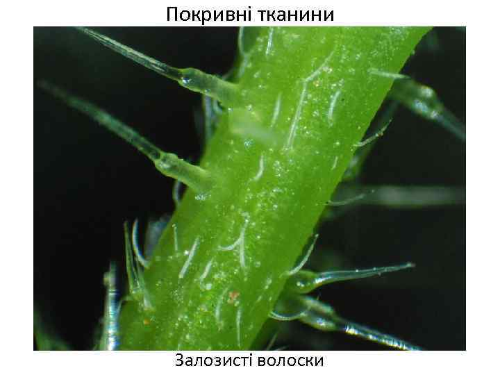 Покривні тканини Залозисті волоски 