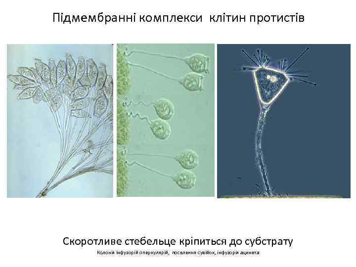 Підмембранні комплекси клітин протистів Скоротливе стебельце кріпиться до субстрату Колонія інфузорій оперкулярій, поселення сувійок,