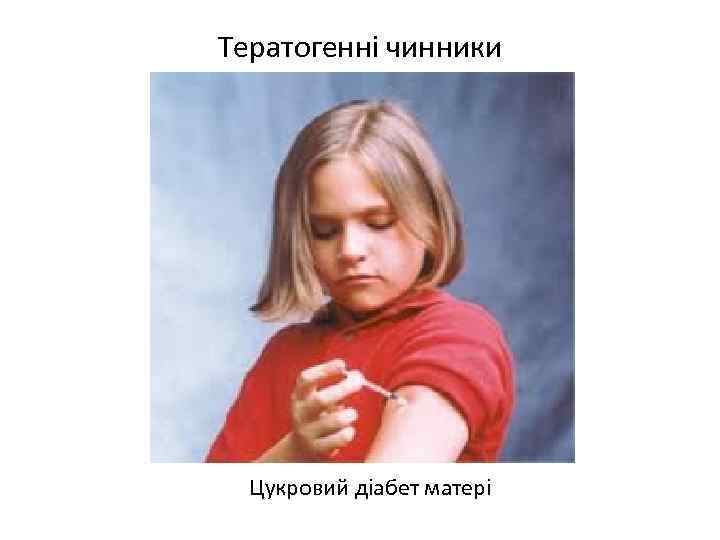 Тератогенні чинники Цукровий діабет матері 