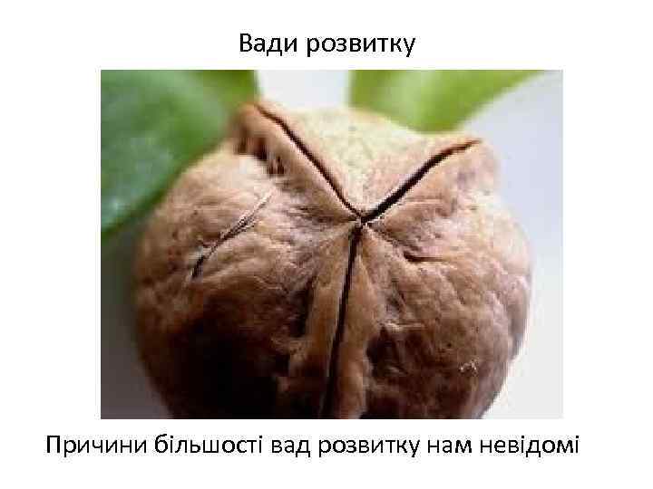 Вади розвитку Причини більшості вад розвитку нам невідомі 