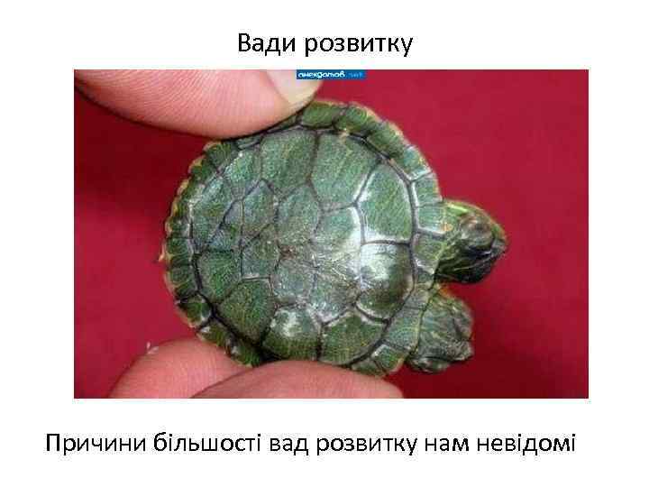 Вади розвитку Причини більшості вад розвитку нам невідомі 