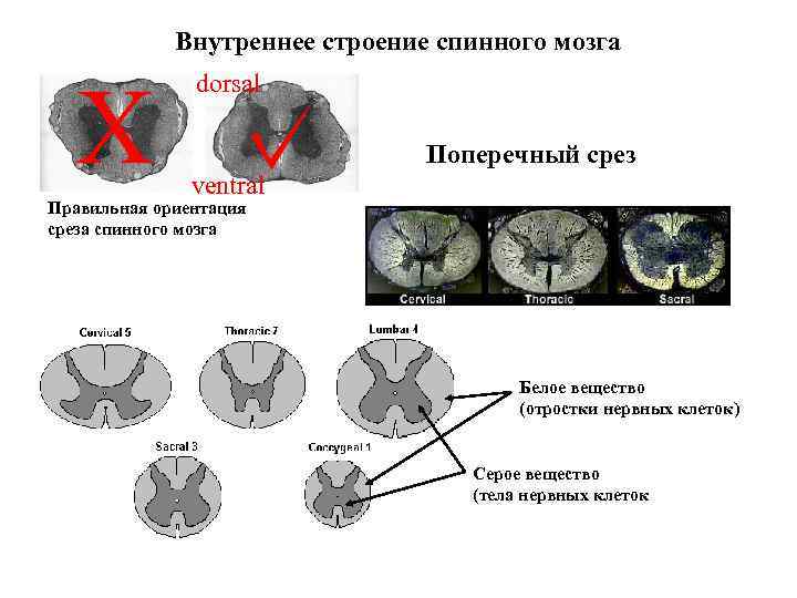 Внутреннее строение спинного мозга X dorsal Поперечный срез ventral Правильная ориентация среза спинного мозга