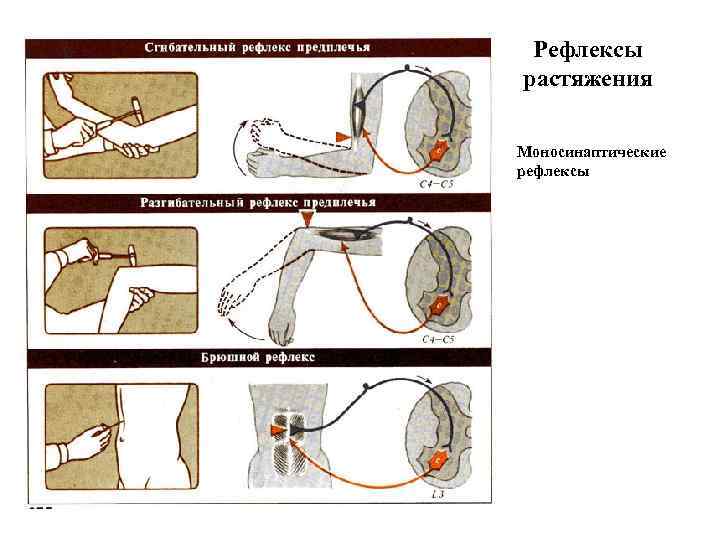 Рефлексы растяжения Моносинаптические рефлексы 