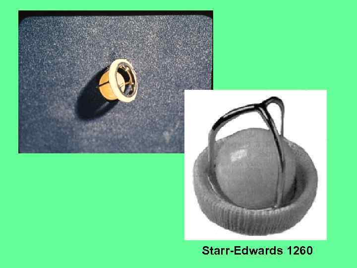 Starr-Edwards 1260 