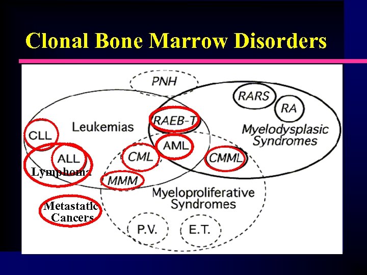 Clonal Bone Marrow Disorders Lymphoma Metastatic Cancers 