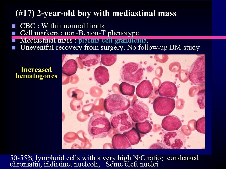(#17) 2 -year-old boy with mediastinal mass n n CBC : Within normal limits