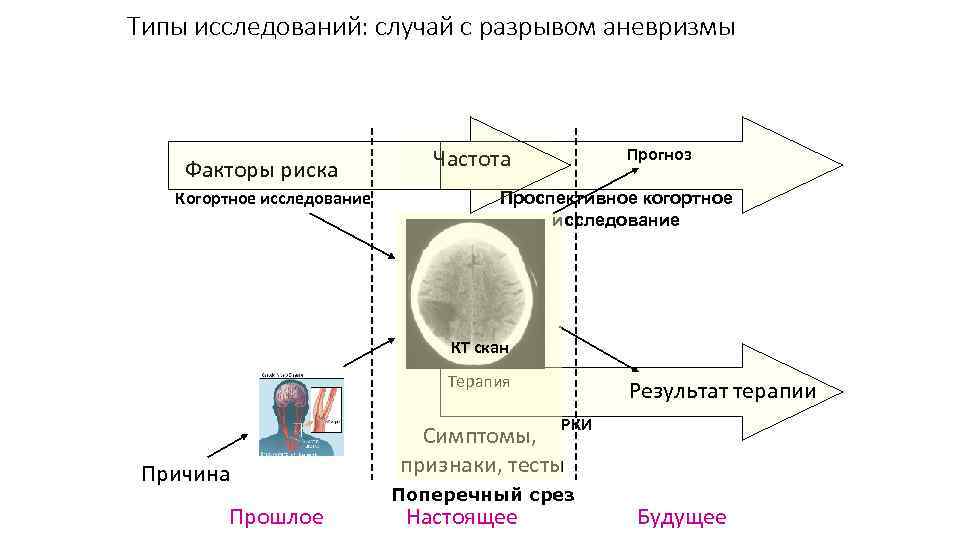 Типы исследований: случай с разрывом аневризмы Факторы риска Когортное исследование Частота Прогноз Проспективное когортное