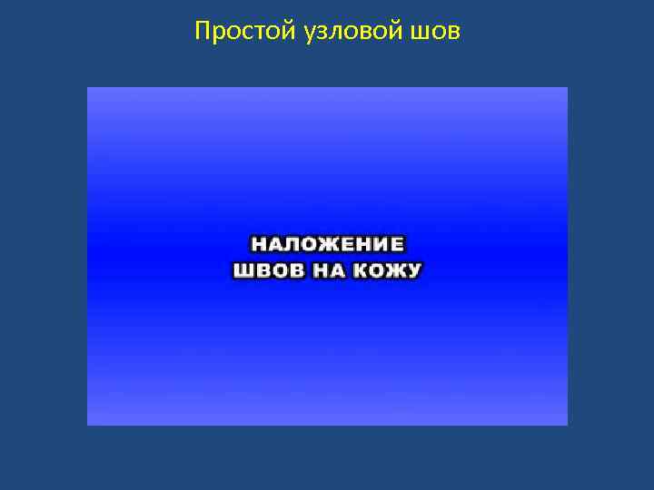 Простой узловой шов 