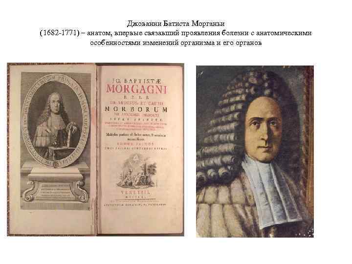 Джованни Батиста Морганьи (1682 -1771) – анатом, впервые связавший проявления болезни с анатомическими особенностями