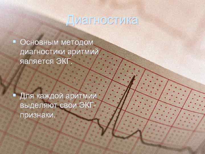 Диагностика § Основным методом диагностики аритмий является ЭКГ. § Для каждой аритмии выделяют свои