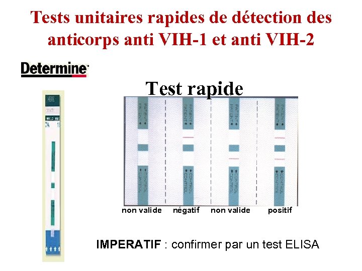 Tests unitaires rapides de détection des anticorps anti VIH-1 et anti VIH-2 Test rapide