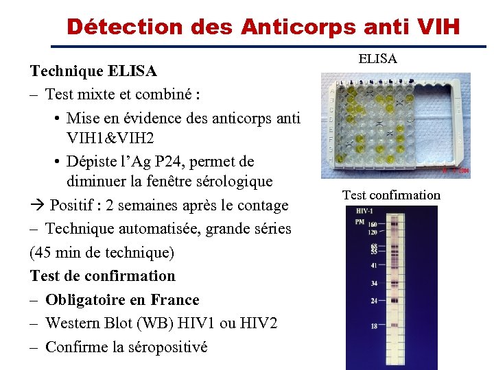 Détection des Anticorps anti VIH Technique ELISA – Test mixte et combiné : •