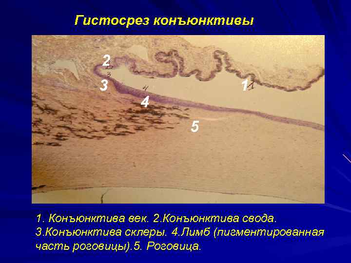 Гистосрез конъюнктивы 2 3 1 4 5 1. Конъюнктива век. 2. Конъюнктива свода. 3.