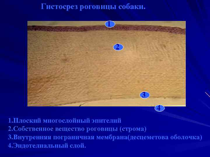 Гистосрез роговицы собаки. 1 2 3 4 1. Плоский многослойный эпителий 2. Собственное вещество