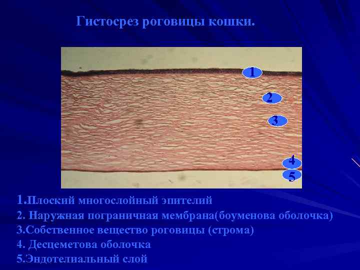 Гистосрез роговицы кошки. 1 2 3 4 5 1. Плоский многослойный эпителий 2. Наружная