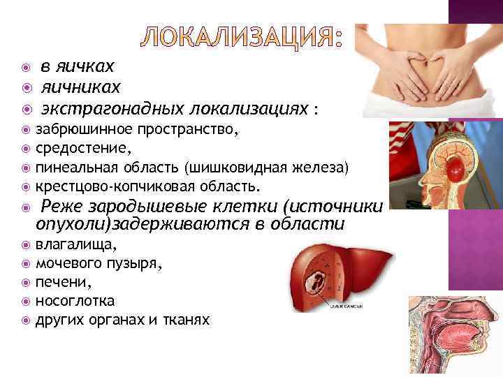  в яичках яичниках экстрагонадных локализациях : забрюшинное пространство, средостение, пинеальная область (шишковидная железа)