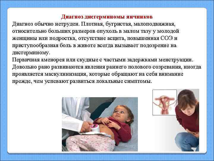 Диагноз дисгерминомы яичников Диагноз обычно нетруден. Плотная, бугристая, малоподвижная, относительно больших размеров опухоль в