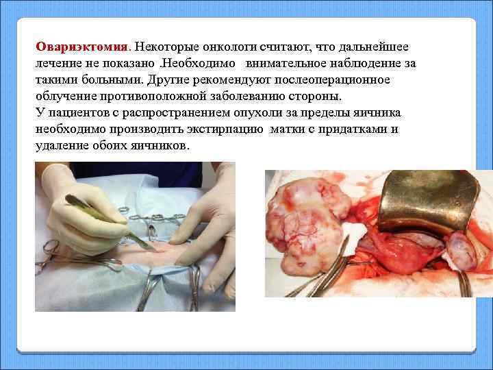 Овариэктомия. Некоторые онкологи считают, что дальнейшее лечение не показано. Необходимо внимательное наблюдение за такими