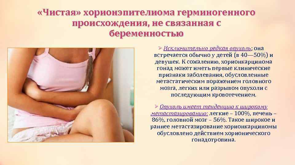  «Чистая» хорионэпителиома герминогенного происхождения, не связанная с беременностью Ø Исключительно редкая опухоль; она