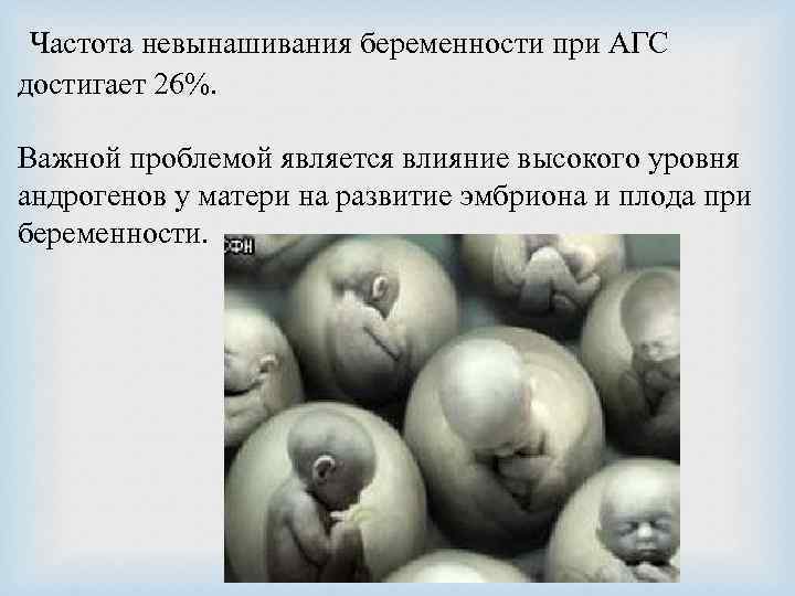  Частота невынашивания беременности при АГС достигает 26%. Важной проблемой является влияние высокого уровня