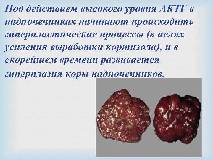 Под действием высокого уровня АКТГ в надпочечниках начинают происходить гиперпластические процессы (в целях усиления