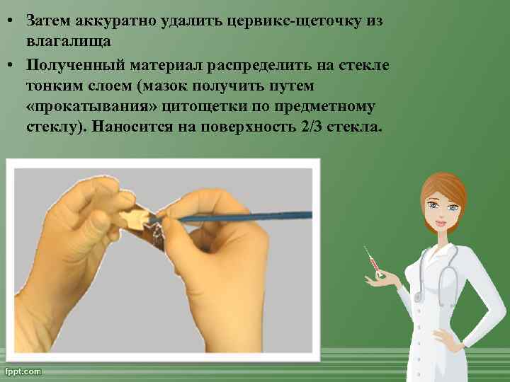  • Затем аккуратно удалить цервикс-щеточку из влагалища • Полученный материал распределить на стекле