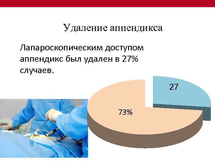 Удаление аппендикса Лапароскопическим доступом аппендикс был удален в 27% случаев. 27% 73% 